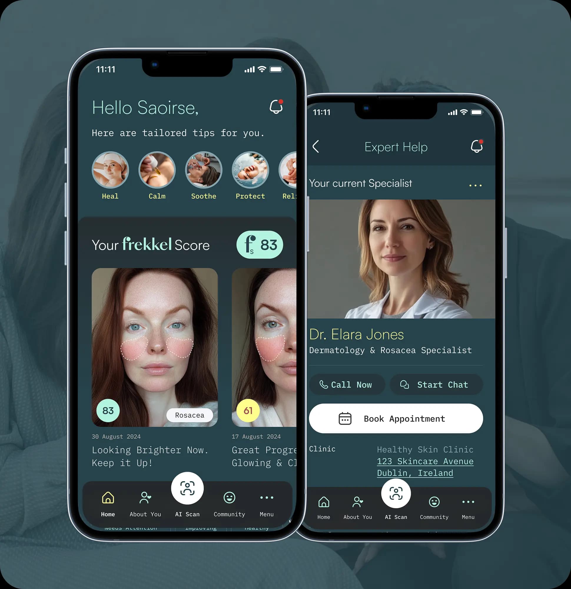 Frekkel App Preview